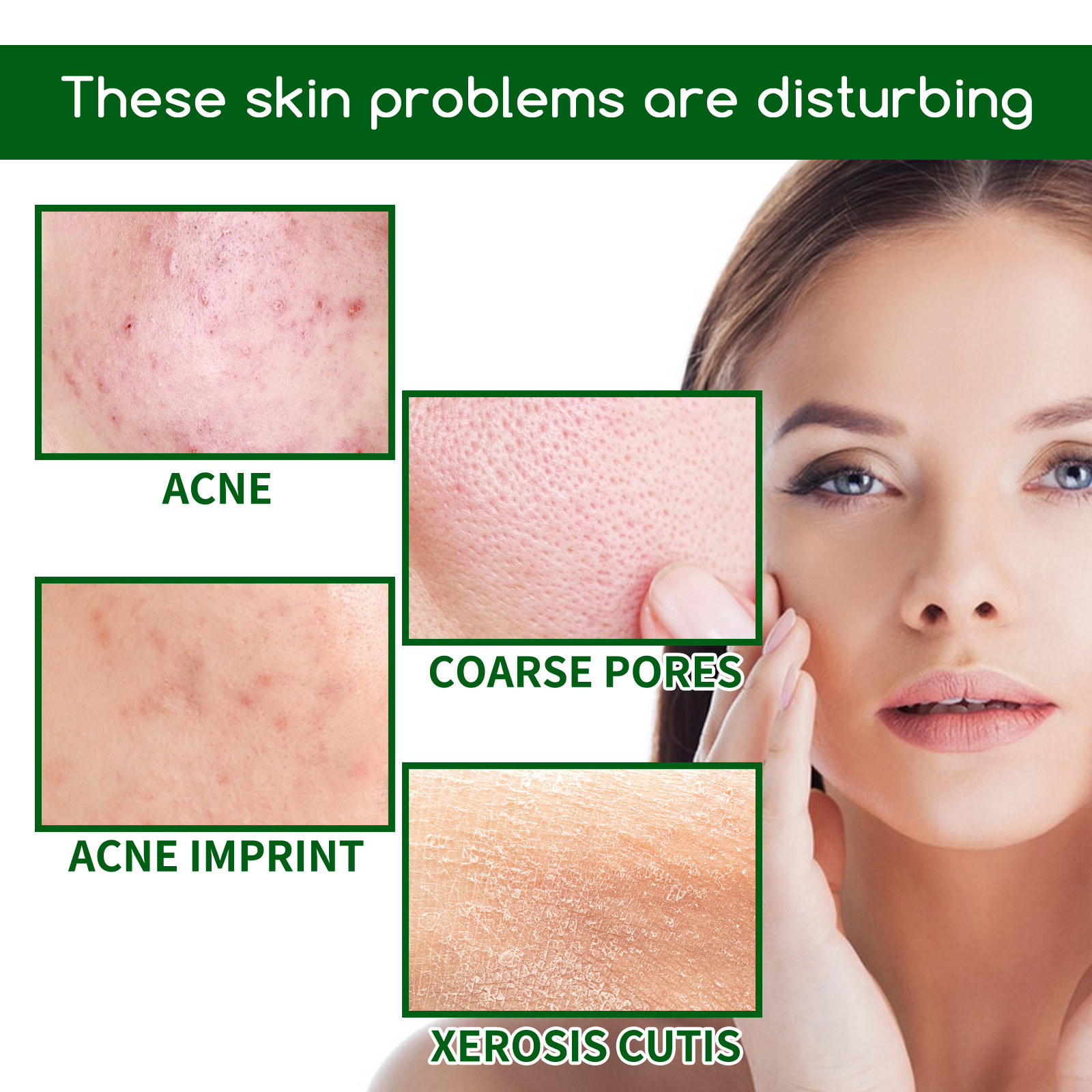 Salicylic Acid Anti Acn-e Face - Tranexamic Acid Serum avis et prix