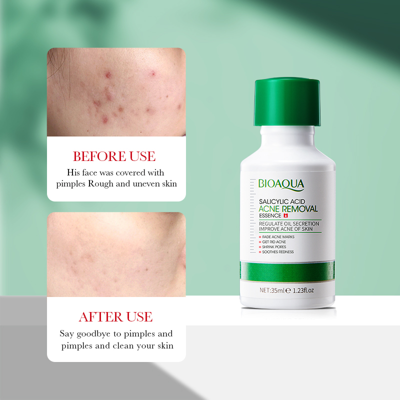 35ml BIOAOUA Salicylic Acid An - Tranexamic Acid Serum avis et prix