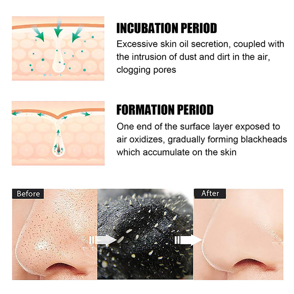 10/20/50/100 Pieces Deep Clean - Charcoal Pore Strip avis et prix
