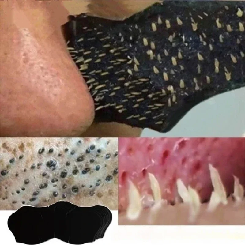 Unisex Blackhead Remove Mask N - Charcoal Pore Strip avis et prix