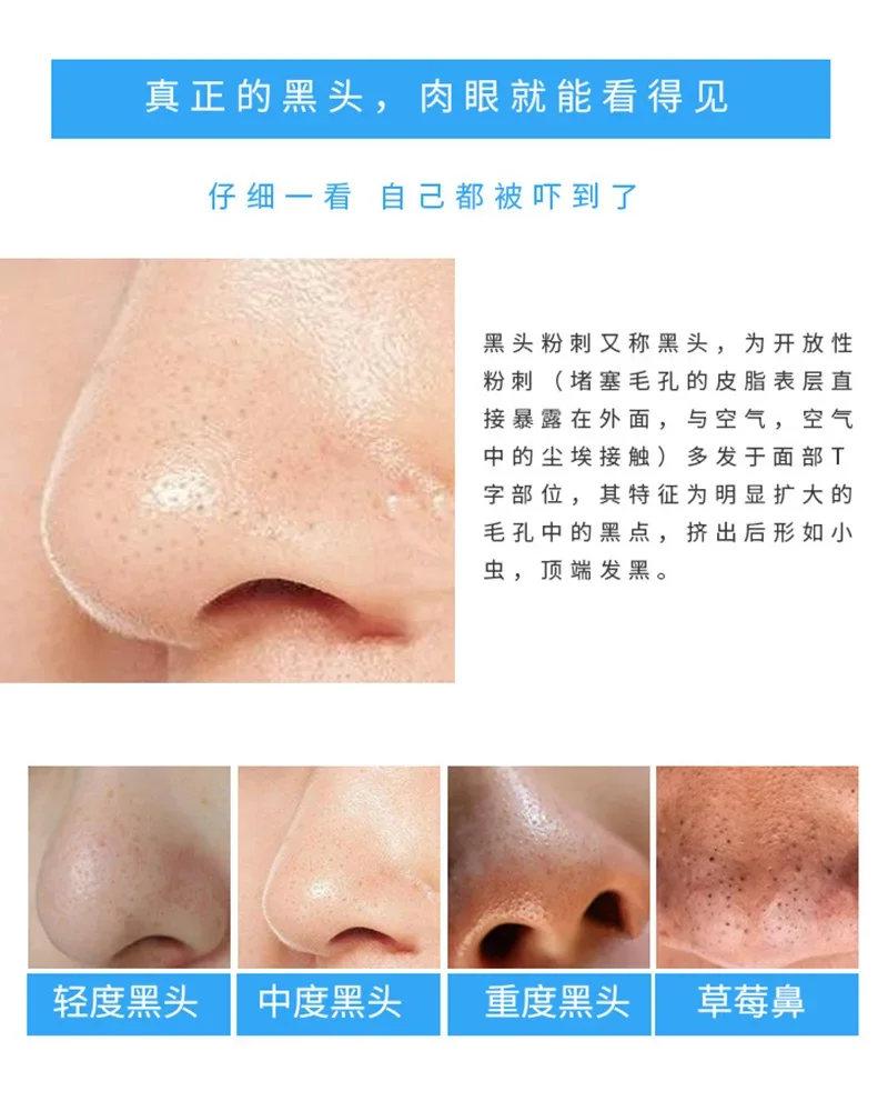 30 Pcs Bamboo Charcoal Nose St - Charcoal Pore Strip avis et prix
