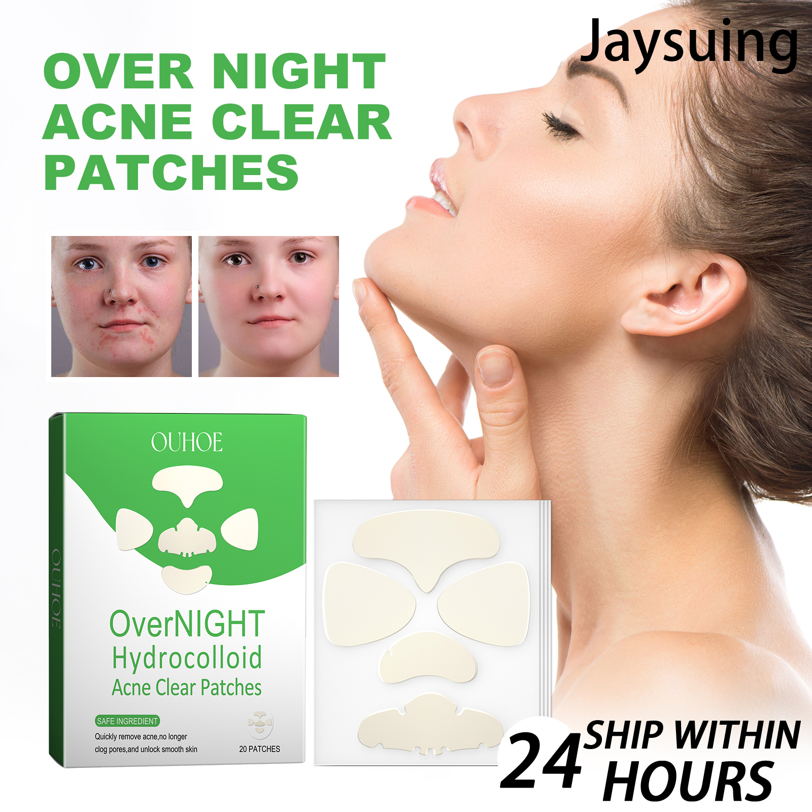 OUHOE Acne Patches for Face 20 - Tea Tree Spot Treatment avis et prix