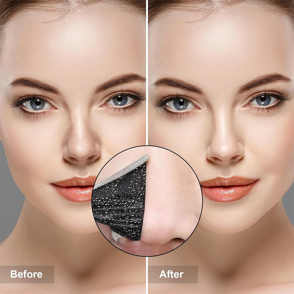 10PCS Unisex Blackhead Remove  - Charcoal Pore Strip avis et prix