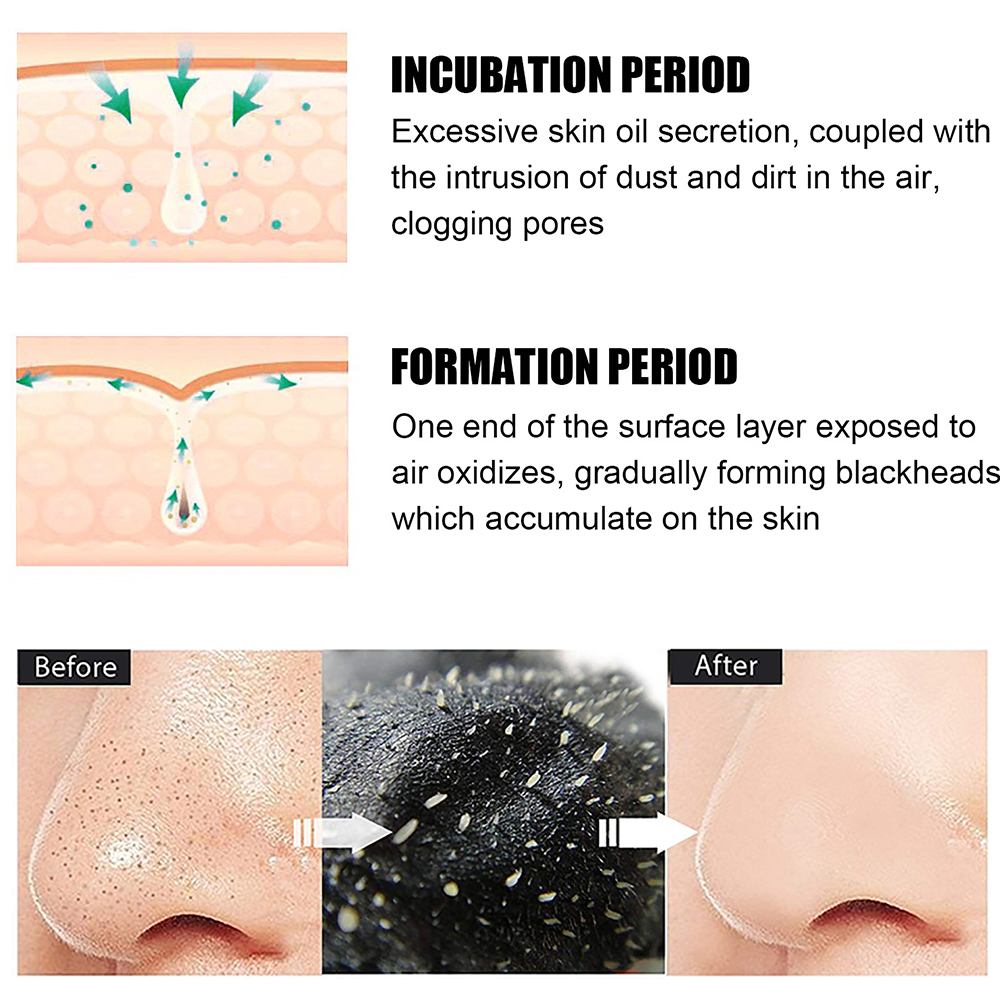 10PCS Unisex Blackhead Remove  - Charcoal Pore Strip avis et prix