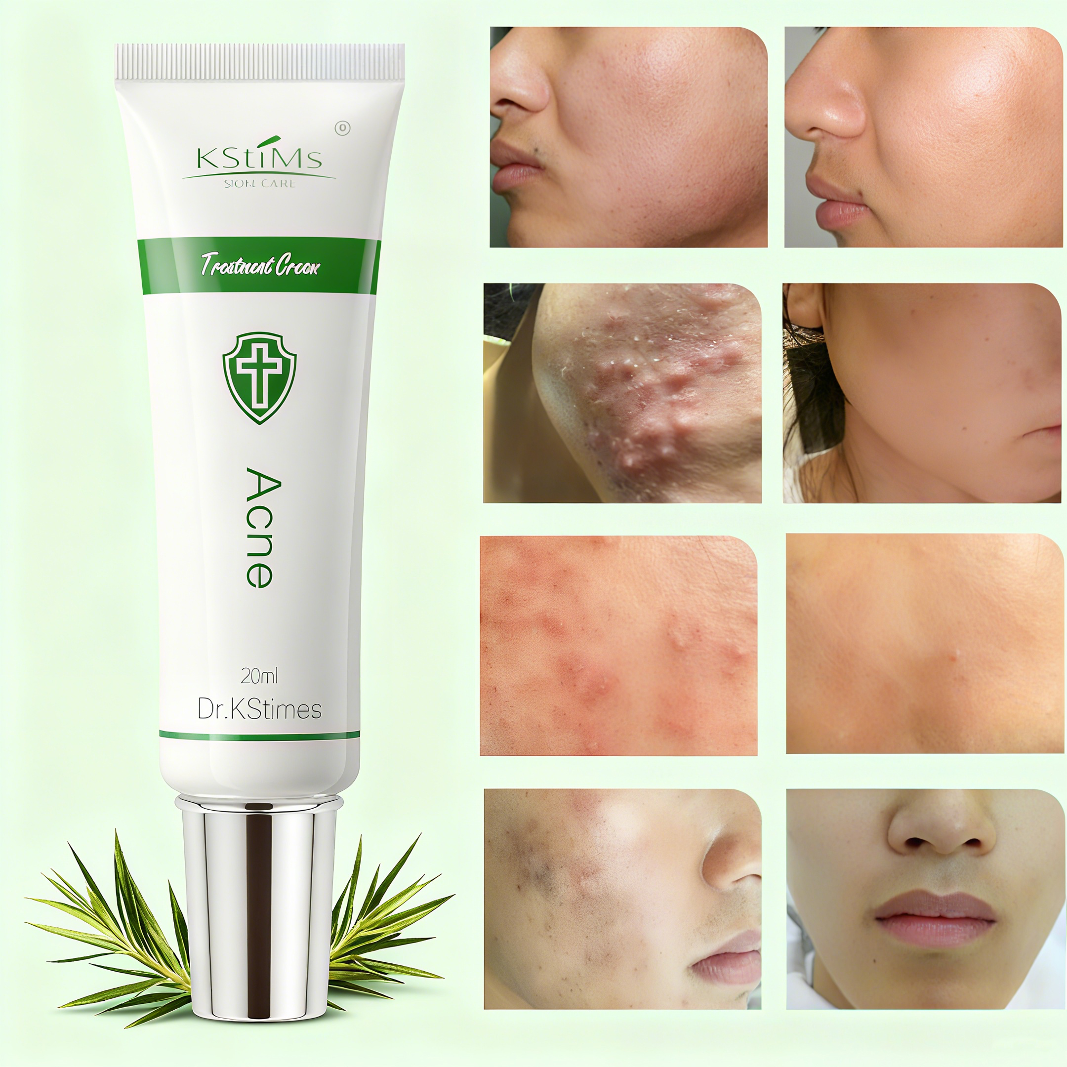 Acne Treatment Face Cream Acne - Tea Tree Spot Treatment avis et prix