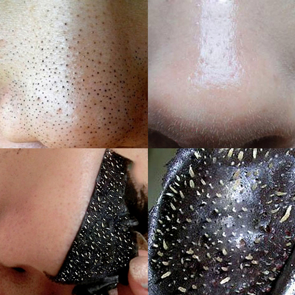 50pcs Nose Blackhead Remover M - Charcoal Pore Strip avis et prix