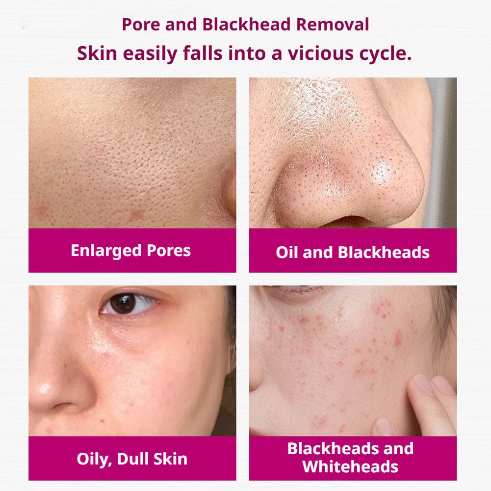 Salicylic Acid Shrink Pores Se - Tranexamic Acid Serum avis et prix