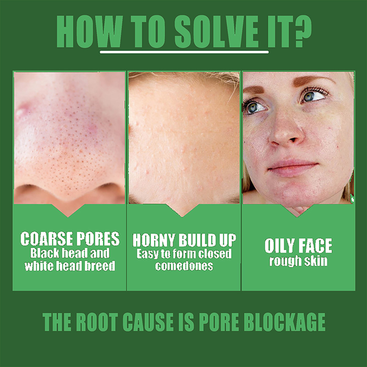 Shrink pores Remove acne marks - Licorice Root Extract avis et prix