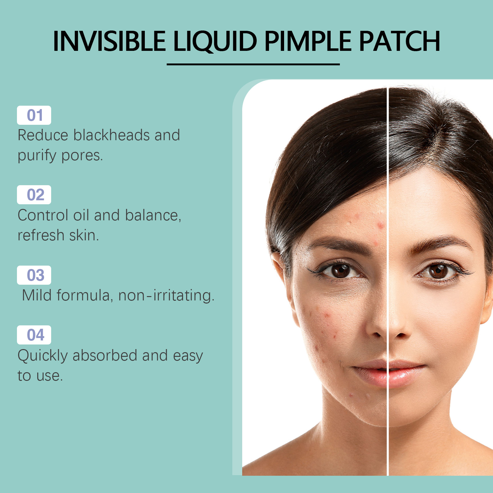 Acne Repair Facial Serum Light - Licorice Root Extract avis et prix