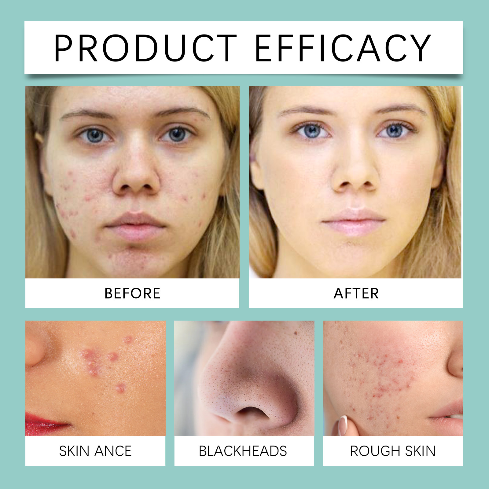 Acne Repair Facial Serum Light - Licorice Root Extract avis et prix