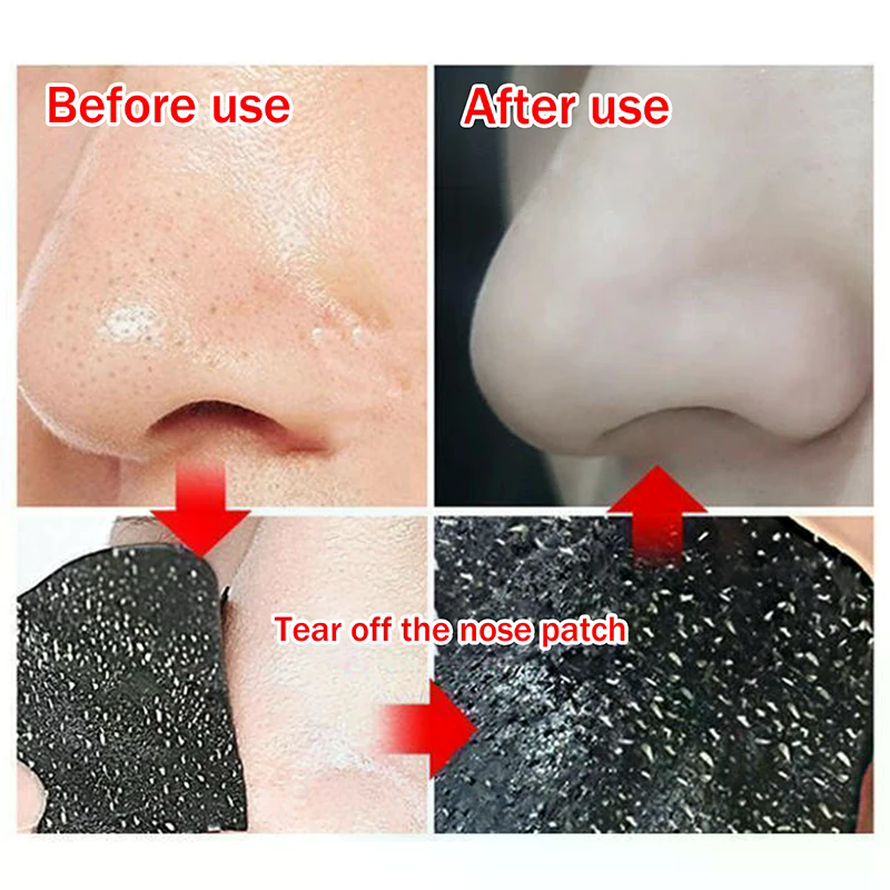 5/15/25/50 Pcs Bamboo Charcoal - Charcoal Pore Strip avis et prix