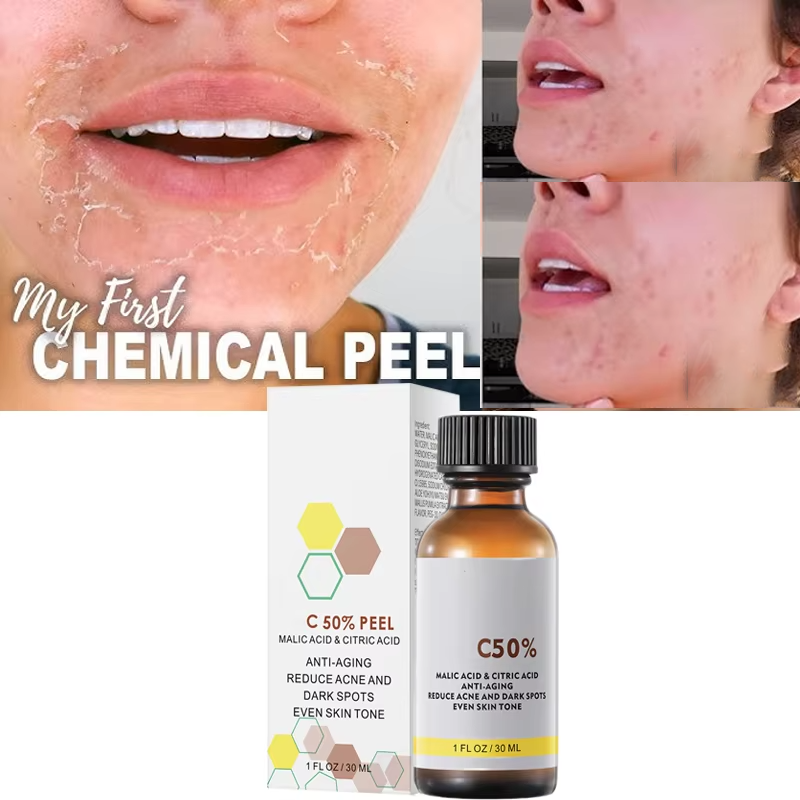 With Malic Acid And Citric Aci - Tranexamic Acid Serum avis et prix