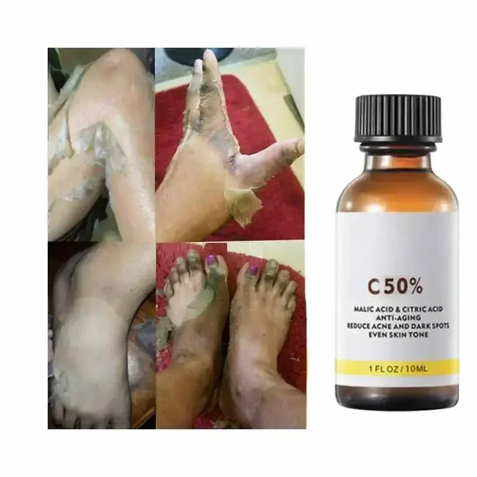 With Malic Acid And Citric Aci - Tranexamic Acid Serum avis et prix